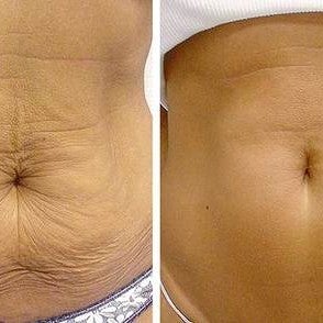 <p>Meer dan 45.000+ Vrouwen gingen je voor<br/><br/></p>