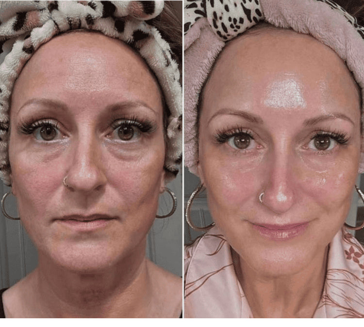 <p>Meer dan 45.000+ Vrouwen gingen je voor<br/><br/></p>
