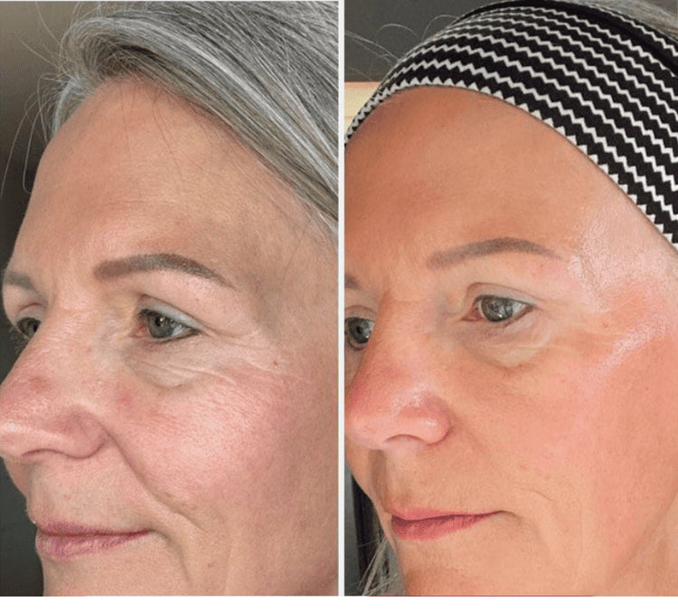 <p>Meer dan 45.000+ Vrouwen gingen je voor<br/><br/></p>