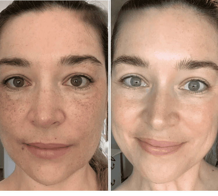 <p>Meer dan 45.000+ Vrouwen gingen je voor<br/><br/></p>