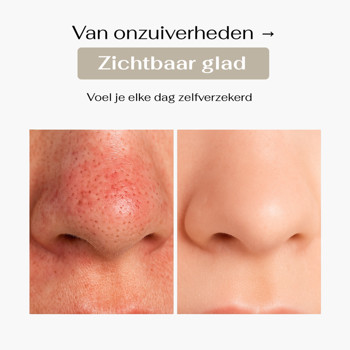SatinSkin™ Pore Cleanser