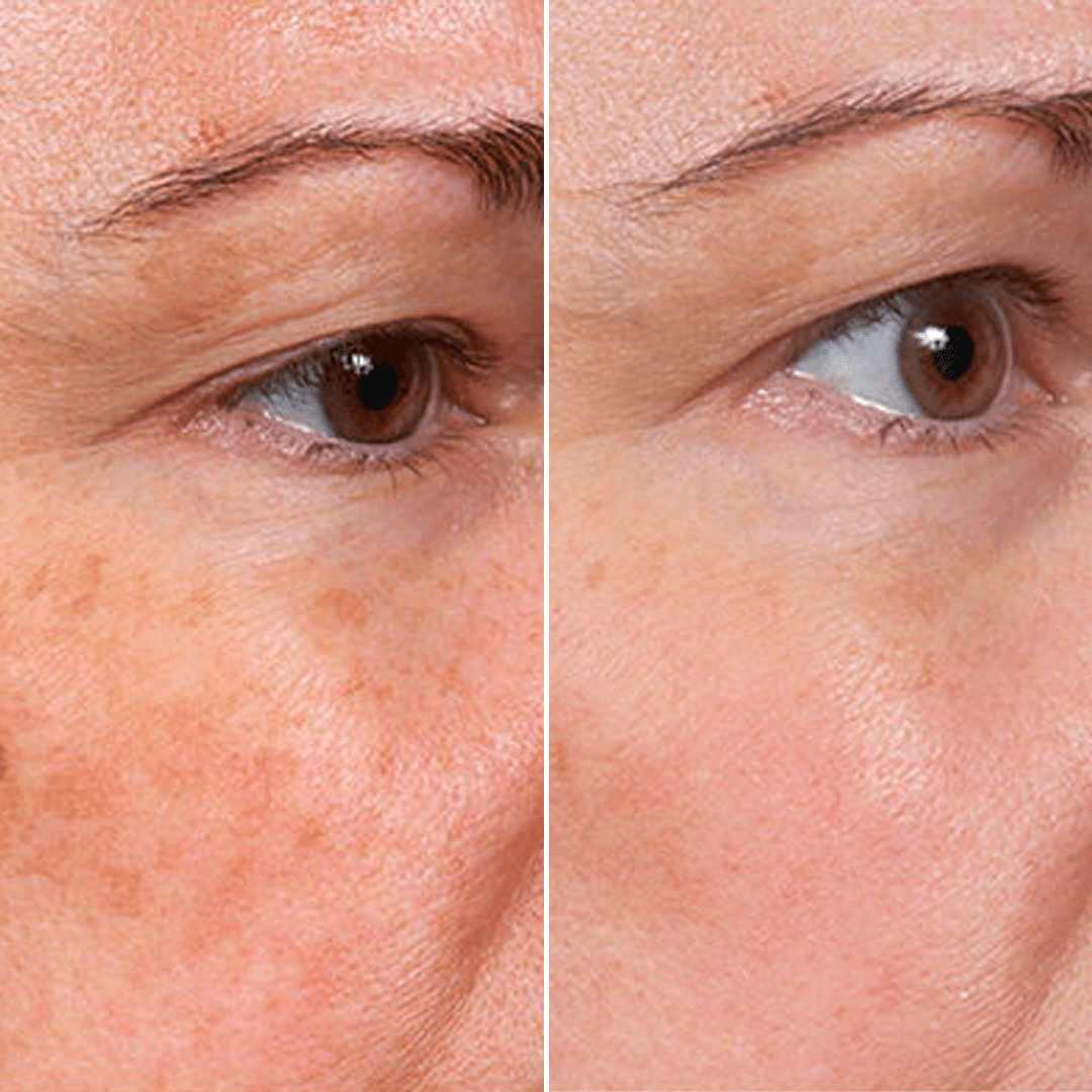 Aluna Age Reset Serum