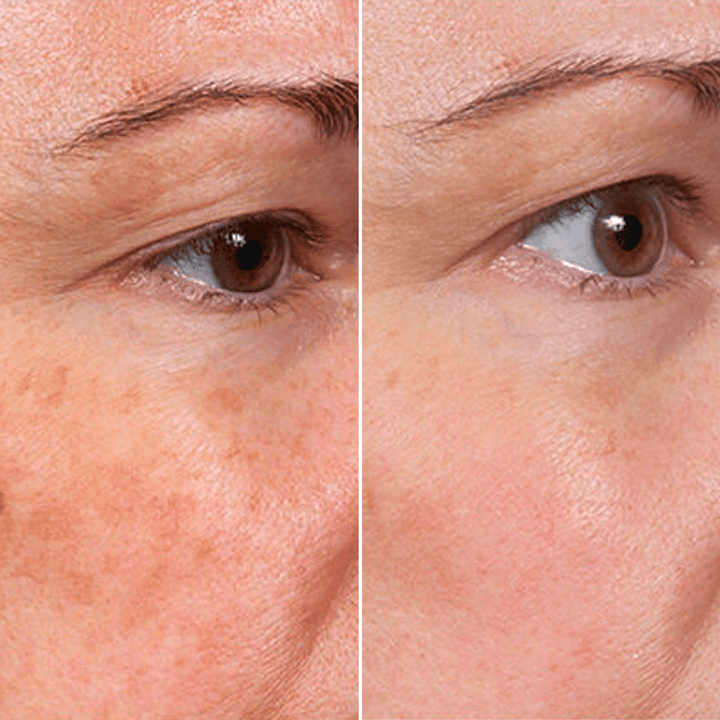 Aluna Age Reset Serum