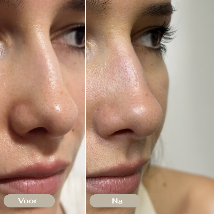 SatinSkin™ Pore Cleanser