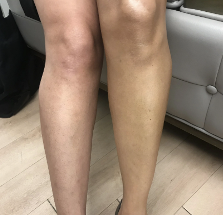 <p>Meer dan 45.000+ Vrouwen gingen je voor</p>