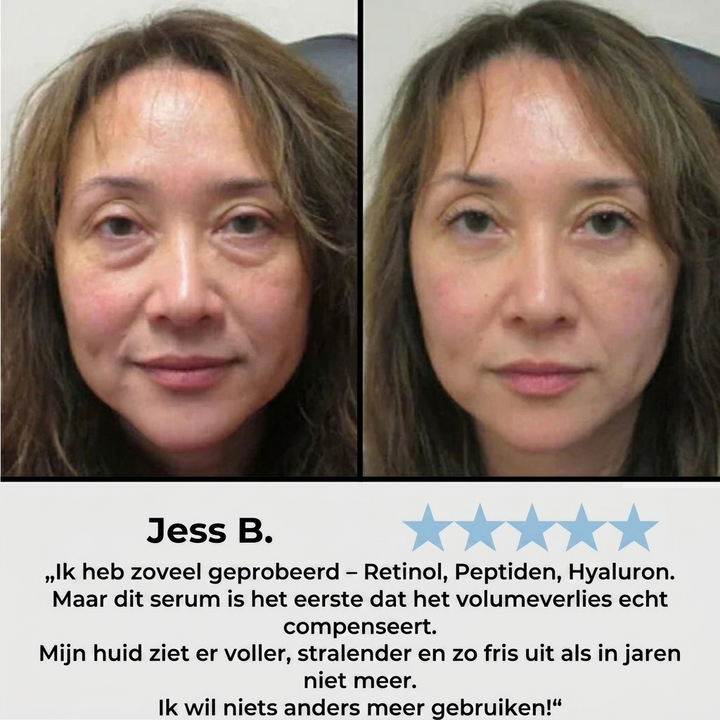 Aluna Koreaans Anti-Aging Serum